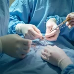 classificação fiscal de tubo de proteção do canal do esôfago